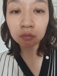 体验前-北京米扬丽格医疗美容·联合丽格鼻整形中心