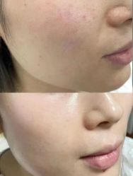 -郡艺医疗美容·微整·眼鼻吸脂