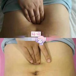 -瑞晨曦催乳产后健康(枣园店)