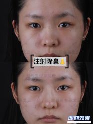 -北京米扬丽格医疗美容·联合丽格鼻整形中心