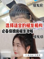 -雍禾植发全国连锁