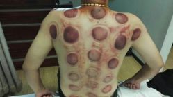 点击看大图 -佳医堂·小儿推拿·产后康复·脊柱养护(新华联家园店)