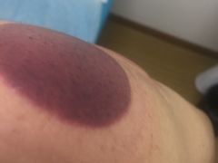 -通透堂中医·精准推拿(旗舰店)
