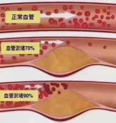 -香薇妮丝·定制减肥·身材管理