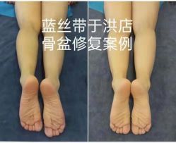 -蓝丝带产后恢复中心(于洪店)