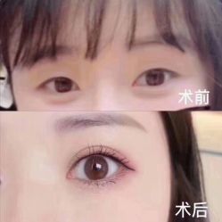 -深圳鹏爱悦心医疗美容医院