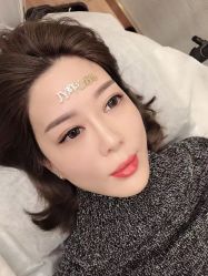 点击看大图 -郡艺医疗美容·微整·眼鼻吸脂