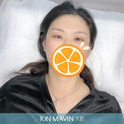 -久匠半永久纹眉