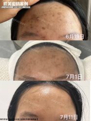 -元熙兰积皮肤管理