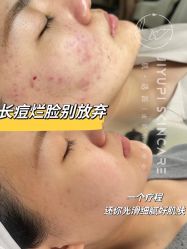 -MLP美丽派·问题肌疗愈中心
