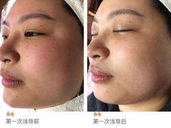 -Cream88颜皮肤管理中心