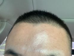 -八大处整形