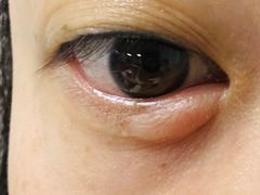 -北京华德眼科医院