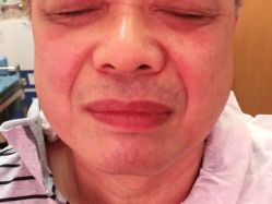 体验前-深圳美莱医疗美容医院