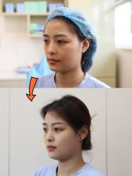 点击看大图 -上海时光整形外科医院