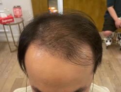 -乐绅男士高端假发定制