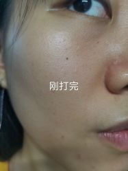 -东莞缔美美容医院