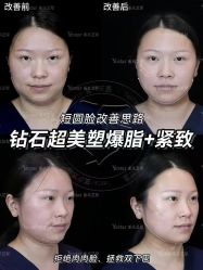 -Yestar重庆艺星医疗美容医院