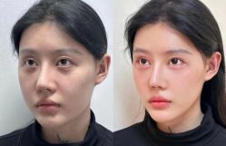 点击看大图 -Yestar艺星医疗美容医院