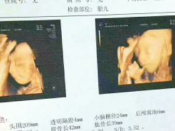 -白领安琪儿妇产医院•早孕•产检•月子中心