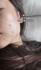 -江油茗汇整形医院
