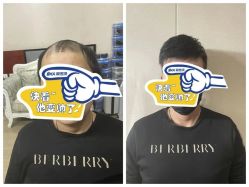 点击看大图 -极客侠男士假发定制补发