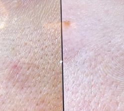 -苑苑vbeauty科技美容SPA