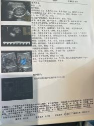 -杭州贝瑞斯美华妇儿医院·早孕·产检·儿科