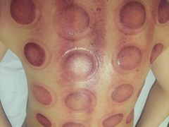 -益友堂盲人推拿正骨穴位按摩工作室