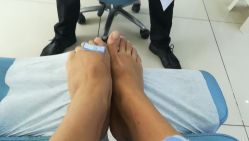 -派恩宜灰指甲鸡眼嵌甲手足癣