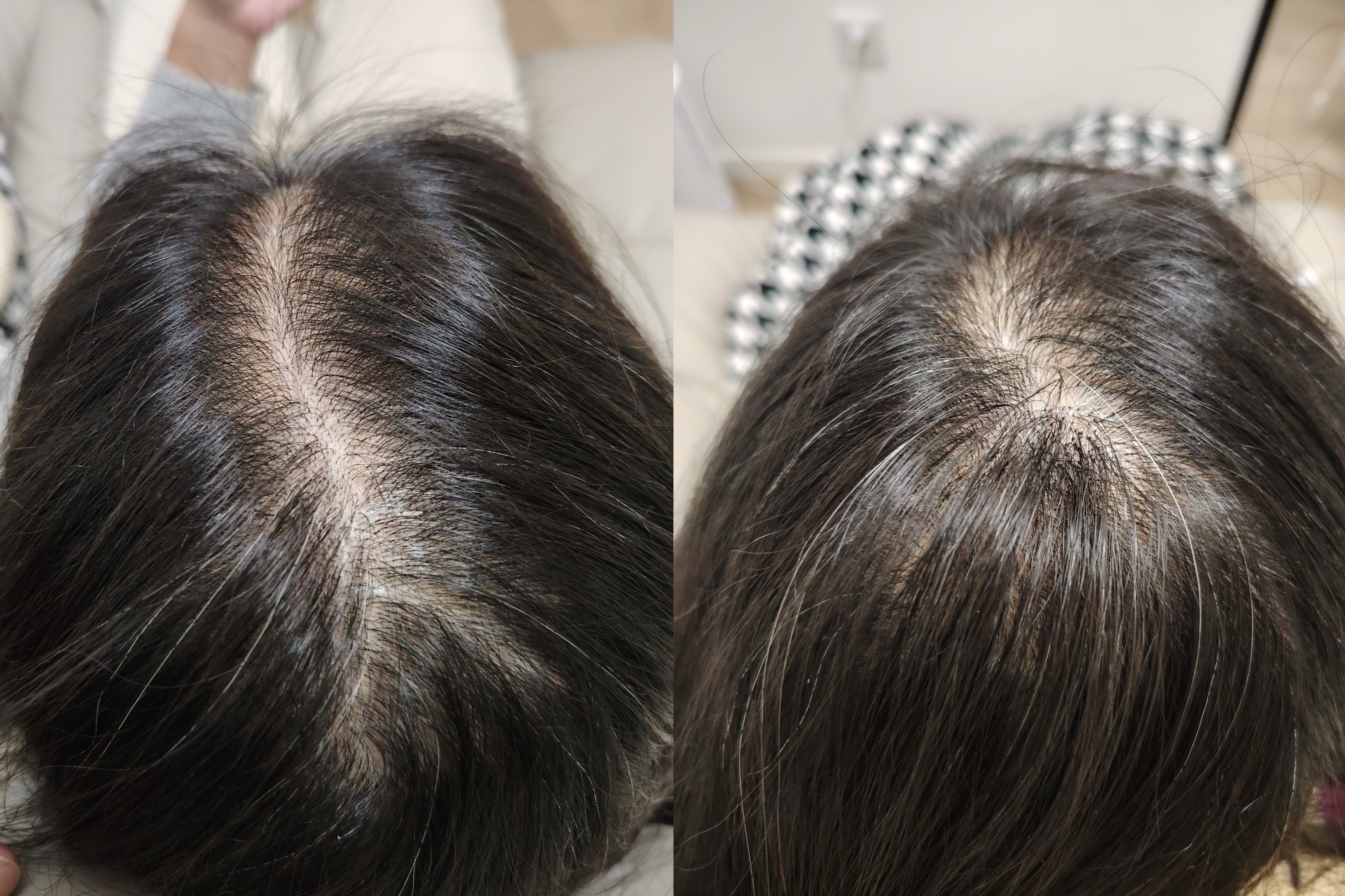 我的头顶有个小秘密