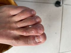 -新甲连锁灰指甲·甲沟炎·鸡眼(黑龙江路店)