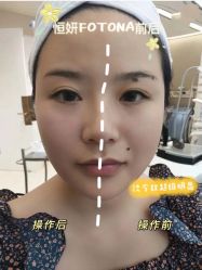 -恒妍医美·韩国定制抗衰中心