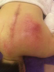 -合肥骄阳兰多产后恢复中心(天鹅湖万达店)