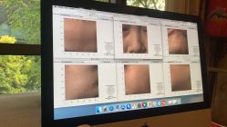 -皇族养心堂·净痘·修敏·御颜