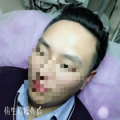 -西施无菌半永久纹绣眉眼影唇轻增发纹发际线