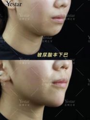 -Yestar艺星医疗美容医院
