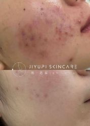 点击看大图 -MLP美丽派·问题肌疗愈中心