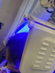 -碧莲盛·不剃发植发