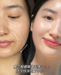 点击看大图 -MLP美丽派·问题肌疗愈中心