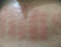 -润泽瑞尼丝医疗美容医院