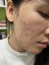 -海峡医疗美容医院