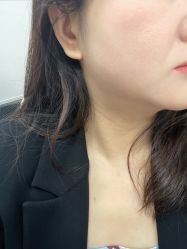 体验后-深圳阳光医疗美容医院·旗舰店