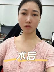 -广东韩妃整形外科医院