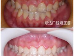 -烟台顺达口腔(辛庄街门诊)