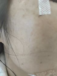 -长沙雅美医疗美容医院