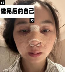 -素美医疗美容·西南眼鼻整形·修复基地