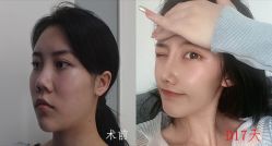 -成都西区医院整形美容