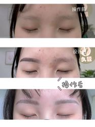 -久匠半永久纹眉
