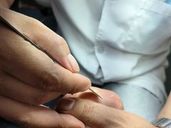 -新甲连锁灰指甲·甲沟炎·鸡眼(黑龙江路店)